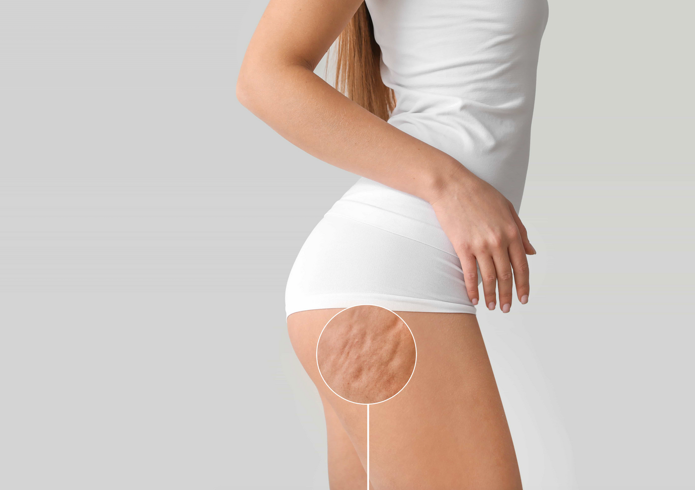 How to get rid of cellulite?