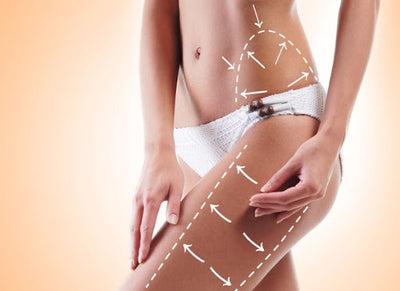 Unveiling the Truth About Anti-Cellulite Lotions: Do They Really Work?